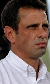 capriles perdedor
